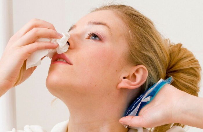 How to stop nosebleeds on Coumadin (Warfarin)