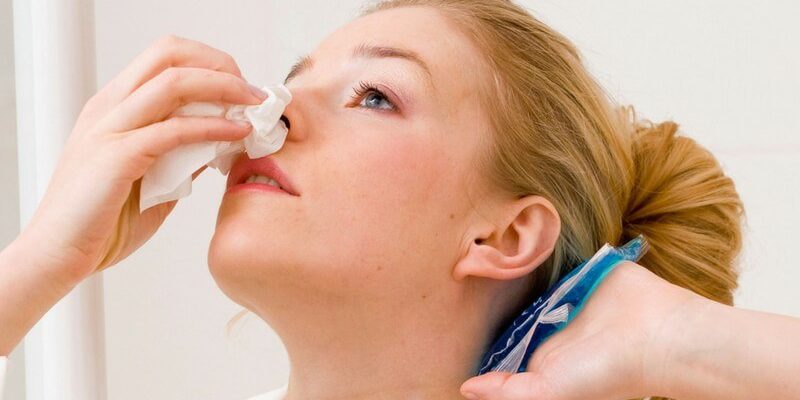 How to stop nosebleeds on Coumadin (Warfarin)